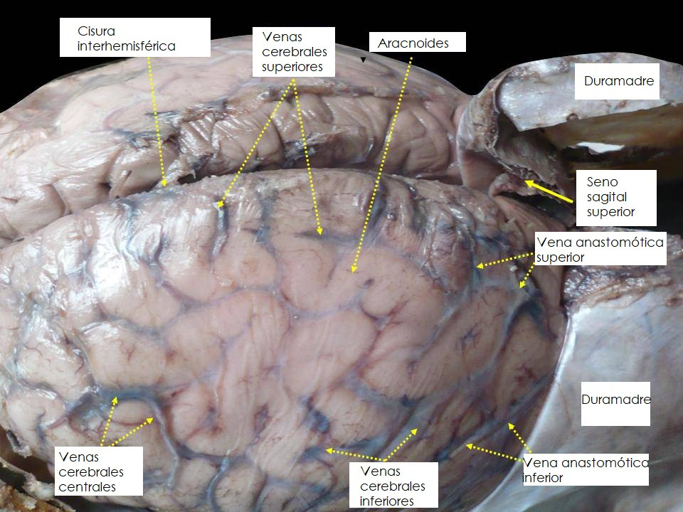 cerebral veins