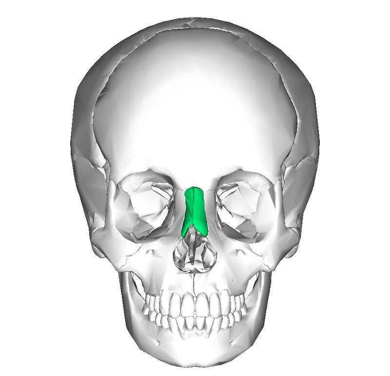 Nasal bone