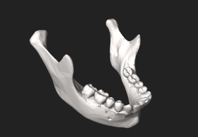 Lower jaw