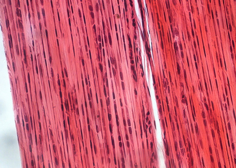 dense connective tissue