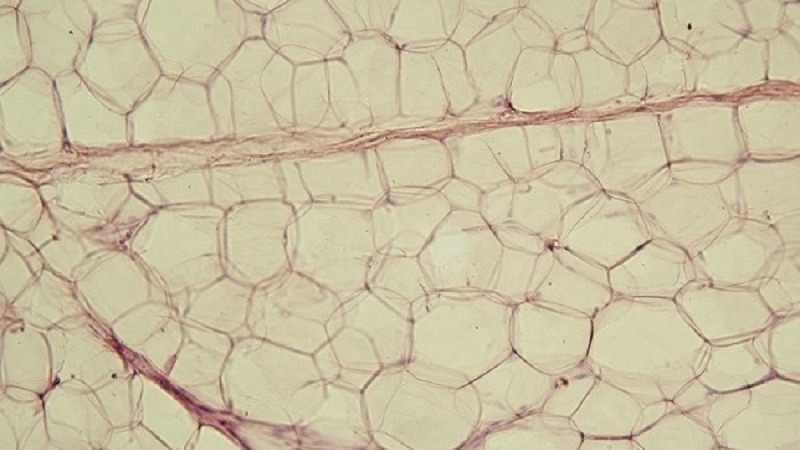 adipose tissue