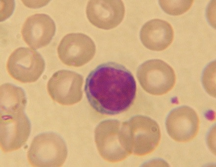 Lymphocyte