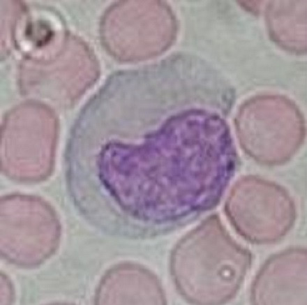 monocyte