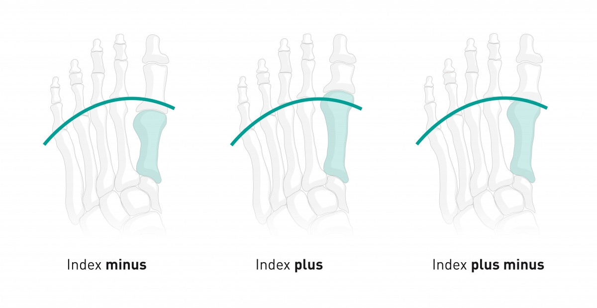 Index plus, index minus, index plus minus