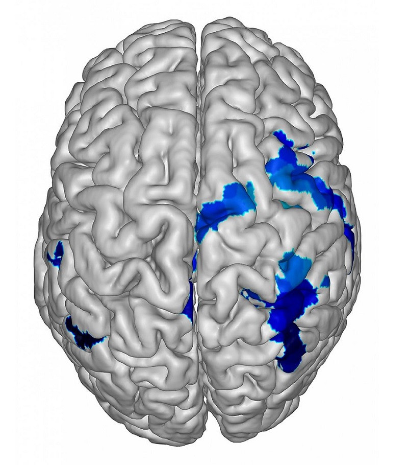 Types of neurorights