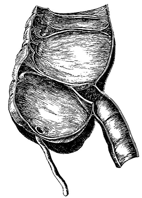 Appendix of the intestine