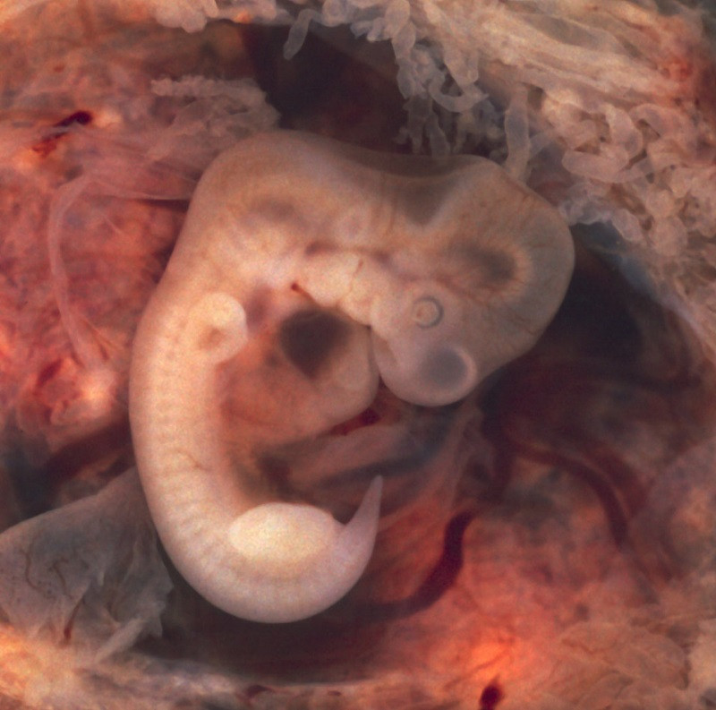 Stages of embryonic development