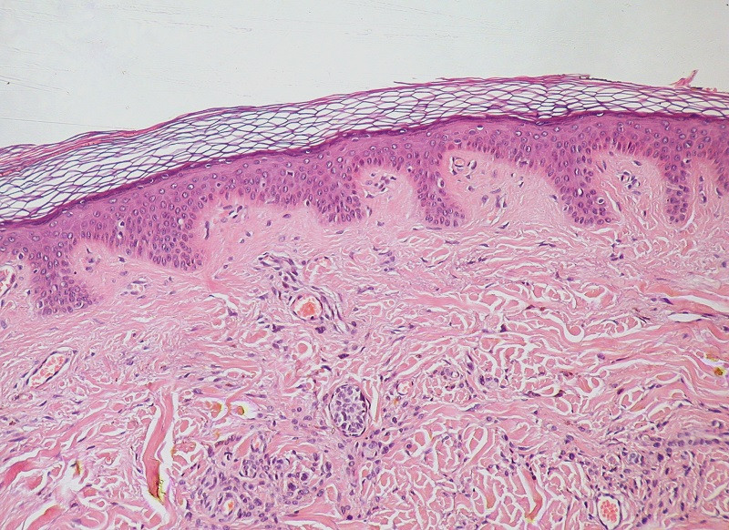 Loose connective tissue