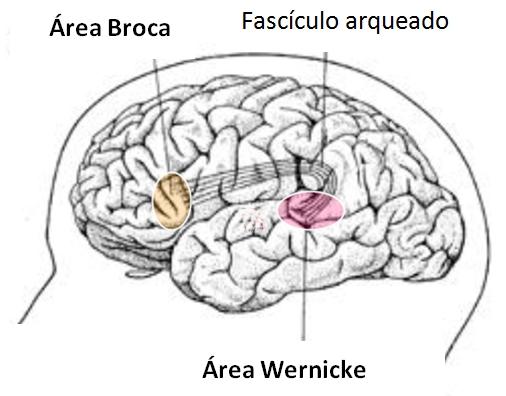 Types of aphasia: characteristics and examples - Conduction aphasia 