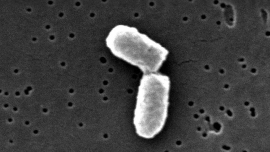 Binary Fission: Characteristics and Phases of This Reproduction Process