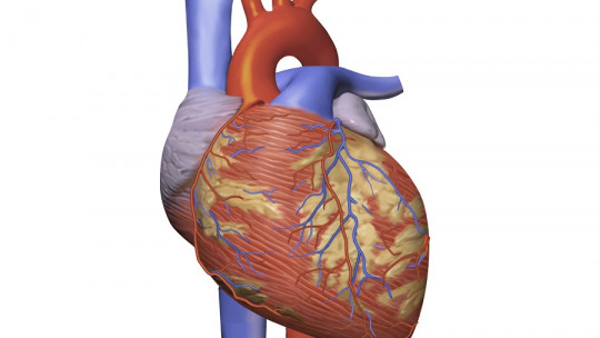 Cardiac coherence