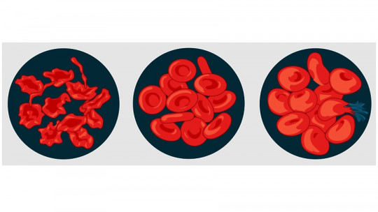 Cytolysis: What it Is, How it Affects the Cell and