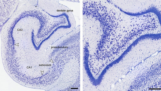 Dentate Gyrus: What it is and What Functions it Plays