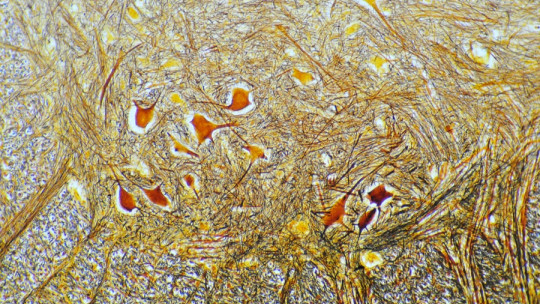 Enteric Nervous System