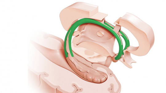 Fornix (or Cerebral Trigone): Anatomy and Functions