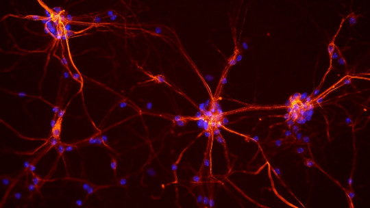 Hebb's Law: the Neuropsychological Basis of Learning