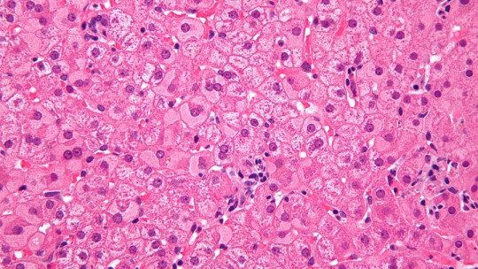 Hepatocytes