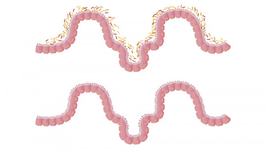 Intestinal Flora: What it Is, Characteristics and Functions