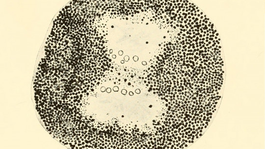 Lysosomes