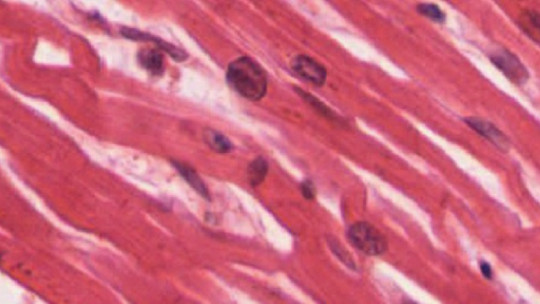 muscle fiber