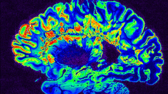 Neurobiology of ADHD