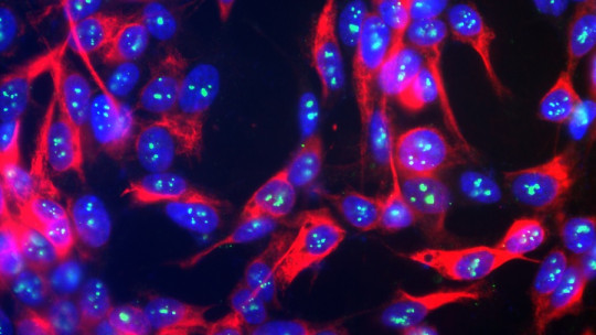 Neurofilaments: What They Are, Components and Characteristics