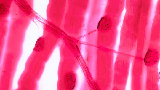 Neuromuscular junction.