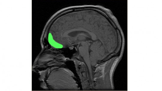 orbitofrontal cortex