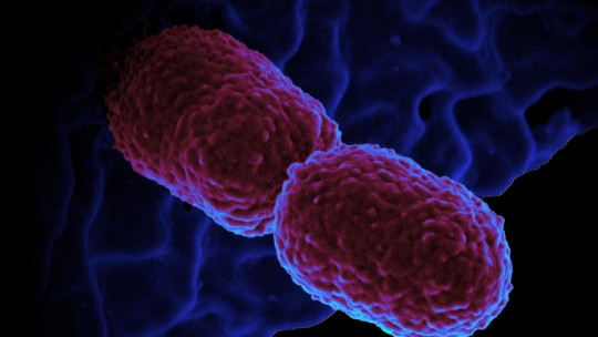 Prokaryotic cells