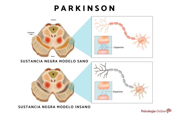 Striatum nucleus: what it is, function and location - Dysfunctions associated with the striatum nucleus