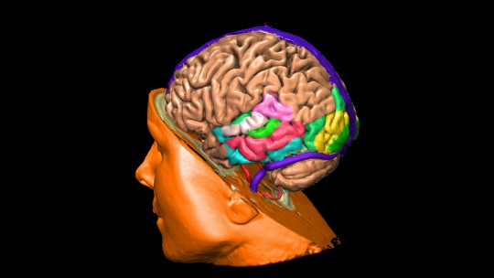 The Male Brain: Differential Structures and Functionality