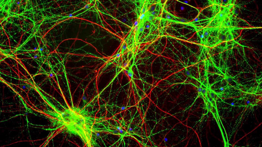 The Serotonergic Hypothesis of Depression