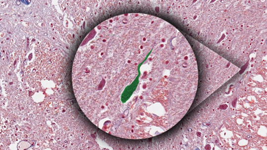 Unipolar Neurons: Characteristics, Location and Functions