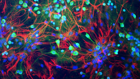 What is a Train of Action Potentials?