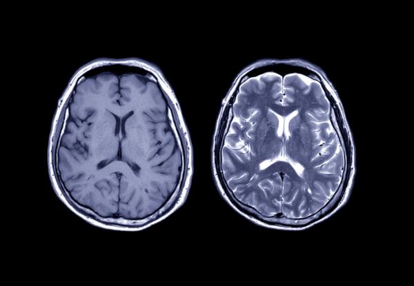 What is cognitive neuroscience and what does it study - Techniques and methods of studying cognitive neuroscience