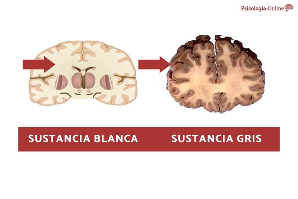 White Matter of the Brain: Definition, Structure, Functions and Lesions