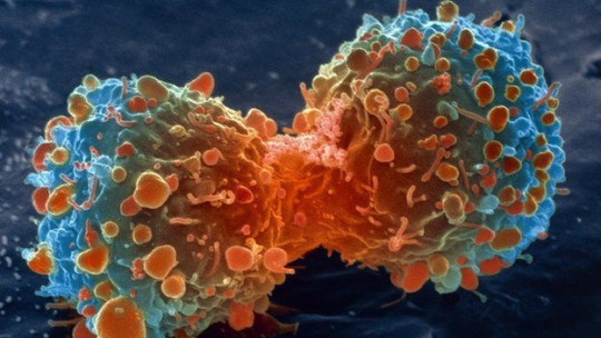 10 Popular Myths About Cancer (and Why They Are False)