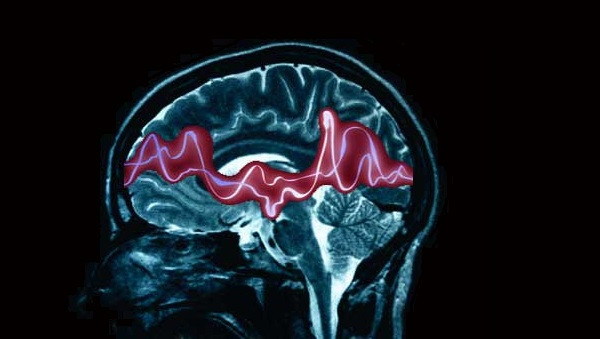 1702497615 223 The lying brain do we really know why we do