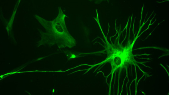 Astrocytes: What Functions Do These Glial Cells Fulfill?