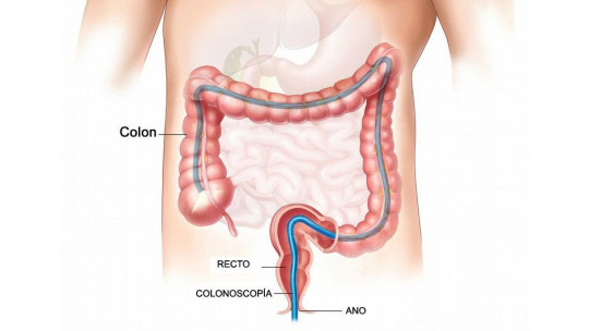 Colonoscopy: What is This Medical Test Used For?