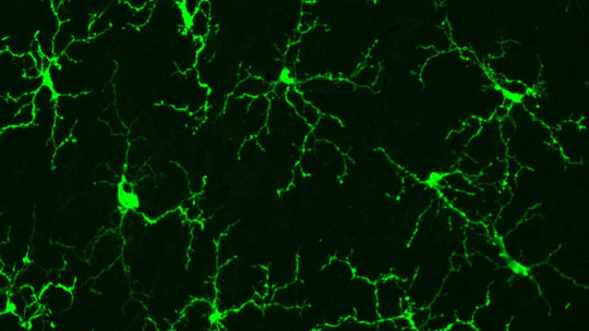 Microglia: Main Functions and Associated Diseases