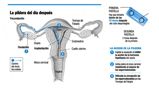 Morning After Pill: 8 Keys to Know How it Works