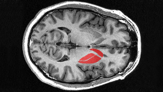 Striatum: Structure, Functions and Associated Disorders