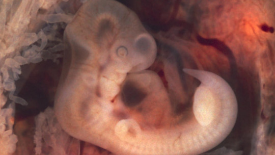 The 3 Phases of Intrauterine or Prenatal Development: from the