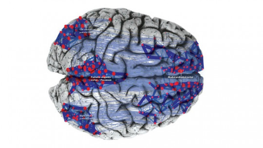 ​the Default Neural Network (dnn) What Happens in Our Brain