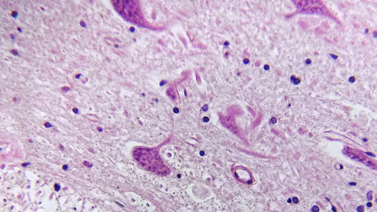 Renshaw cells