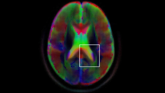 What is Cognitive Science? Its Basic Ideas and Development Phases