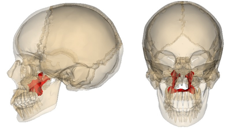 Palatine bone