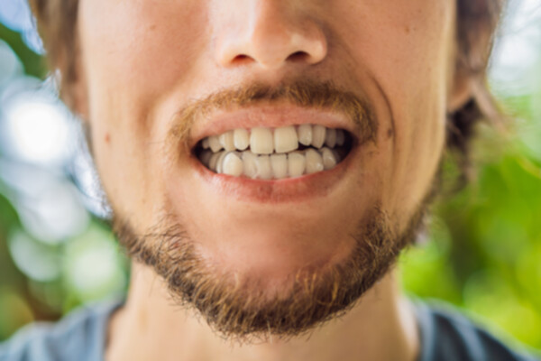 Bruxism treatment