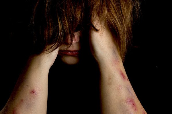 9 Reasons for Self Harm: Why Do People Start Harming Themselves?